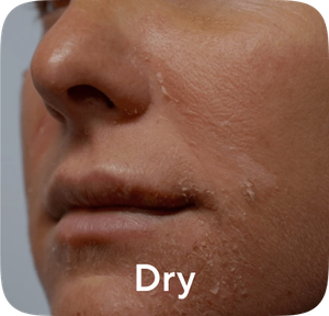 Dry