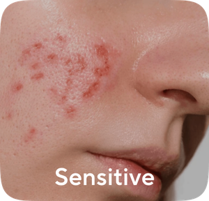 Sensitive