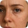 Dry